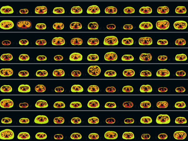 Multiple brain scans in rows